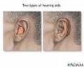 Hearing Aids - Have You Heard Of Beltone Hearing Aids